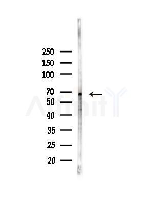 Phospho-Tau (Ser416)[Ser733] Antibody - Western blot analysis of lysates from Hela cells(heat-shock,45min treatment), using Phospho-Tau (Ser416)[Ser733] Antibody at 1/1000 dilution.