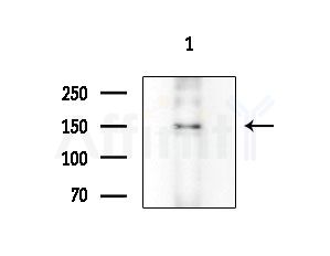 Phospho-TBC1D1 (Ser237) Antibody - Western blot analysis of extracts from EC304 cells, using Phospho-TBC1D1 (Ser237) Antibody at 1/1000 dilution.