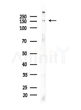 Phospho-TBC1D1 (Ser237) Antibody - Western blot analysis of lysates from EC304 cells, using Phospho-TBC1D1 (Ser237) Antibody at 1/1000 dilution.