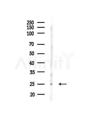 Phospho-TCTP (Ser46) Antibody - Western blot analysis of lysates from Hela cells(starvation,24h treatment), using Phospho-TCTP (Ser46) Antibody at 1/1000 dilution.