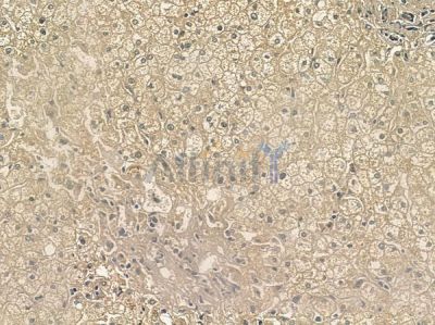 Phospho-TIE2 (Tyr992) Antibody - AF2424 at 1/100 staining human normal liver tissue by IHC-P.