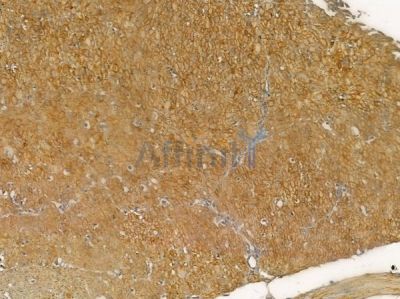 Phospho-TNK1 (Tyr277) Antibody - AF2426 at 1/100 staining human normal gastric tissue by IHC-P.