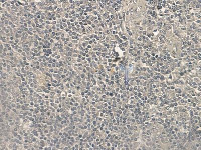 Phospho-ULK1 (Ser467) Antibody - AF2432 at 1/100 staining human normal tonsil tissue by IHC-P.