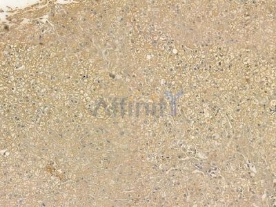 Phospho-WIPI2 (Ser413) Antibody - AF2434 at 1/100 staining human normal liver tissue by IHC-P.
