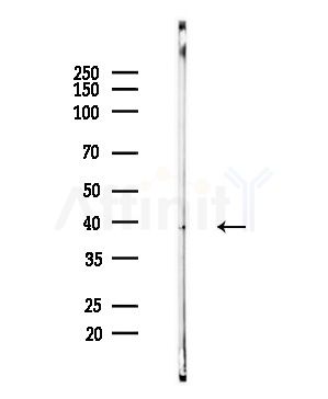 Phospho-CDK6 (Tyr13) Antibody - Western blot analysis of lysates from Mouse brain, using Phospho-CDK6 (Tyr13) Antibody at 1/1000 dilution.