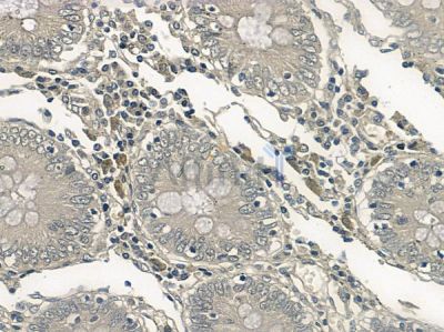 Phospho-CDK6 (Tyr24) Antibody - AF2440 at 1/100 staining human normal colon tissue by IHC-P.