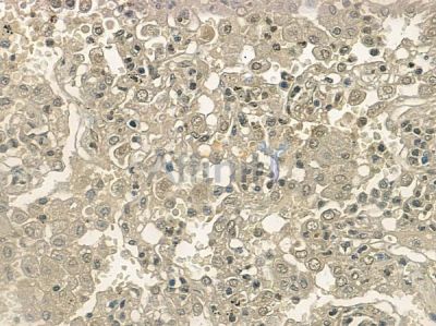 Phospho-CDK6 (Tyr292) Antibody - AF2441 at 1/100 staining human normal lung tissue by IHC-P.