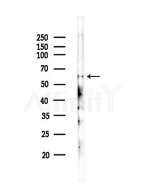 CTDSPL2 Antibody - Western blot analysis of lysates from COLO205 cells(heat-shock,45min treatment), using CTDSPL2 Antibody at 1/1000 dilution.