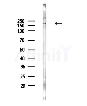 Rictor Antibody - Western blot analysis of lysates from Hela cells(UV,30min treatment), using Rictor Antibody at 1/1000 dilution.