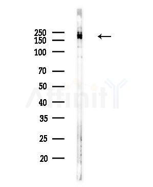 Rictor Antibody - Western blot analysis of lysates from COLO205 cells(UV,30min treatment), using Rictor Antibody at 1/1000 dilution.