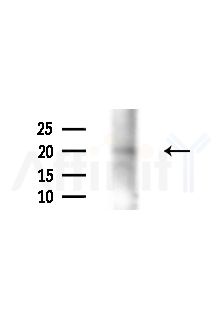 Phospho-HSP20 (Ser16) Antibody - Western blot analysis of extracts from PC12 cells(starvation,24h treatment), using Phospho-HSP20 (Ser16) Antibody at 1/1000 dilution.