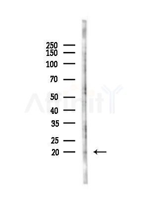 Phospho-HSP20 (Ser16) Antibody - Western blot analysis of lysates from PC12 cells(starvation,24h treatment), using Phospho-HSP20 (Ser16) Antibody at 1/1000 dilution.