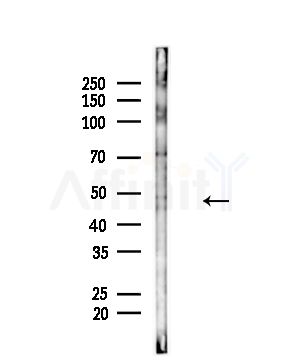 Phospho-Chk1 (Ser296) Antibody - Western blot analysis of lysates from A375 cells(heat-shock,45min treatment), using Phospho-Chk1 (Ser296) Antibody at 1/1000 dilution.