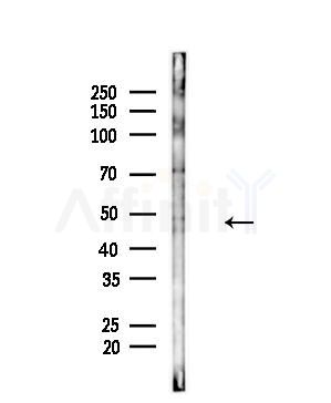 Phospho-Chk1 (Ser296) Antibody - Western blot analysis of lysates from A375 cells(heat-shock,45min treatment), using Phospho-Chk1 (Ser296) Antibody at 1/1000 dilution.