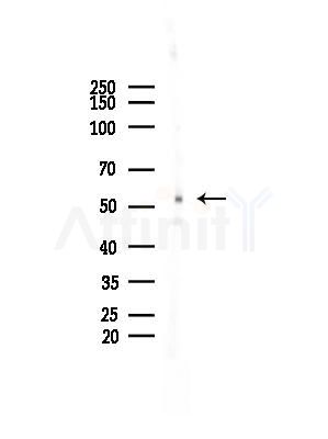 Phospho-Chk1 (Ser345) Antibody - Western blot analysis of lysates from EC304 cells, using Phospho-Chk1 (Ser345) Antibody at 1/1000 dilution.