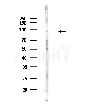 Phospho-IKK beta (Tyr188) Antibody - Western blot analysis of lysates from COLO205 cells(UV,30min treatment), using Phospho-IKK beta (Tyr188) Antibody at 1/1000 dilution.