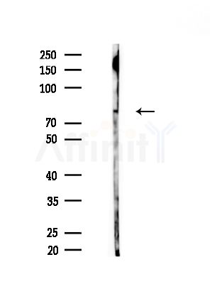 Phospho-IKK alpha/ beta (Ser180/Ser181) Antibody - Western blot analysis of lysates from B16F10-LUC cells(starvation,24h treatment), using Phospho-IKK alpha/ beta (Ser180/Ser181) Antibody at 1/1000 dilution.