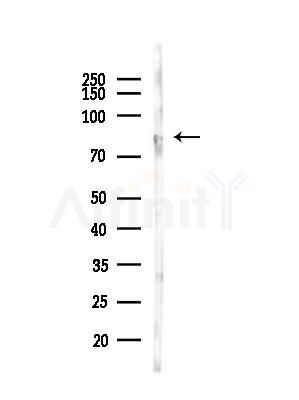 Phospho-p73 (Tyr99) Antibody - Western blot analysis of lysates from LoVo cells(heat-shock,45min treatment), using Phospho-p73 (Tyr99) Antibody at 1/1000 dilution.