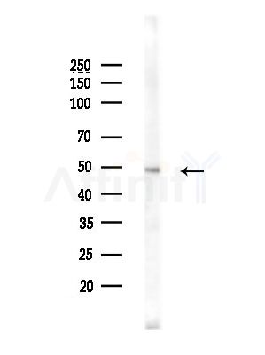 Phospho-HDAC3 (Ser424) Antibody - Western blot analysis of lysates from Hela cells(heat-shock,45min treatment), using Phospho-HDAC3 (Ser424) Antibody at 1/1000 dilution.