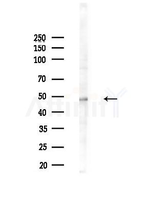Phospho-HDAC3 (Ser424) Antibody - Western blot analysis of lysates from LoVo cells(heat-shock, 45min treatment), using Phospho-HDAC3 (Ser424) Antibody at 1/1000 dilution.