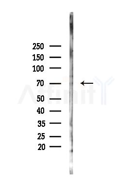 Phospho-TAK1 (Thr187) Antibody - Western blot analysis of lysates from PC12 cells(heat-shock,45min treatment), using Phospho-TAK1 (Thr187) Antibody at 1/1000 dilution.