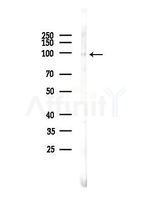 Phospho-FOXO3A (Ser253) Antibody - Western blot analysis of lysates from Rat brain, using Phospho-FOXO3A (Ser253) Antibody at 1/1000 dilution.