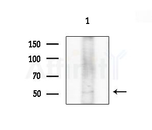 Phospho-DOK2 (Tyr299) Antibody - Western blot analysis of extracts from EC304 cells, using Phospho-DOK2 (Tyr299) Antibody at 1/1000 dilution.
