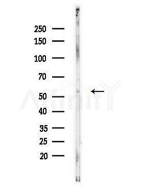 Phospho-DOK2 (Tyr299) Antibody - Western blot analysis of lysates from EC304 cells, using Phospho-DOK2 (Tyr299) Antibody at 1/1000 dilution.