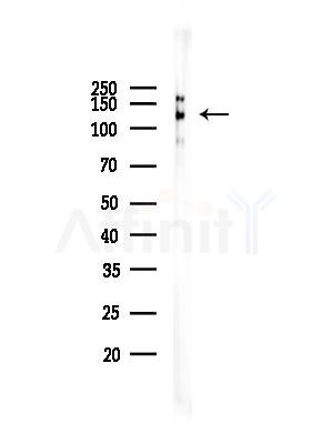 Phospho-JAK2 (Tyr570) Antibody - Western blot analysis of lysates from COLO205 cells(heat-shock treatment), using Phospho-JAK2 (Tyr570) Antibody at 1/1000 dilution.