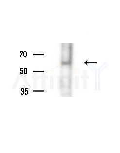 Phospho-MITF (Ser180) Antibody - Western blot analysis of extracts from B16F10-LUC cells(LPS,4h treatment), using Phospho-MITF (Ser180) Antibody at 1/1000 dilution.