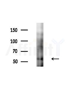 Phospho-MITF (Ser180) Antibody - Western blot analysis of extracts from PC12 cells(starvation,24h treatment), using Phospho-MITF (Ser180) Antibody at 1/1000 dilution.