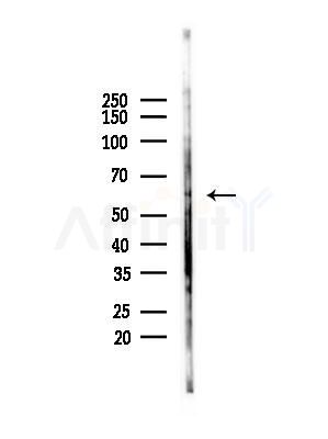 Phospho-MITF (Ser180) Antibody - Western blot analysis of lysates from PC12 cells(starvation,24h treatment), using Phospho-MITF (Ser180) Antibody at 1/1000 dilution.