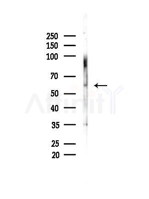 Phospho-MITF (Ser180) Antibody - Western blot analysis of lysates from B16F10-LUC cells(LPS,4h treatment), using Phospho-MITF (Ser180) Antibody at 1/1000 dilution.