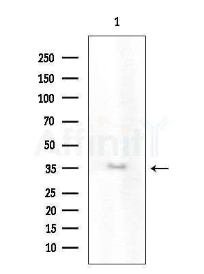 Phospho-SNAIL (Ser246) Antibody - Western blot analysis of extracts from COLO205 cells(heat-shock treatment), using Phospho-SNAIL (Ser246) Antibody at 1/1000 dilution.
