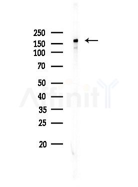 Phospho-EGFR (Ser1070) Antibody - Western blot analysis of lysates from EC304 cells, using Phospho-EGFR (Ser1070) Antibody at 1/1000 dilution.