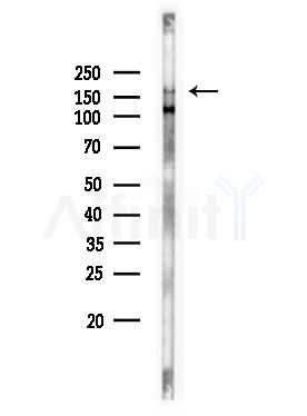 Phospho-EGFR (Tyr1068)[Tyr1092] Antibody - Western blot analysis of lysates from EC304 cells, using Phospho-EGFR (Tyr1068)[Tyr1092] Antibody at 1/1000 dilution.