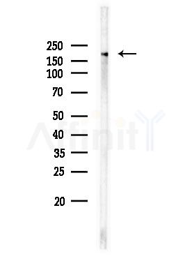 Phospho-EGFR (Tyr1173)[Tyr1197] Antibody - Western blot analysis of lysates from EC304 cells, using Phospho-EGFR (Tyr1173)[Tyr1197] Antibody at 1/1000 dilution.