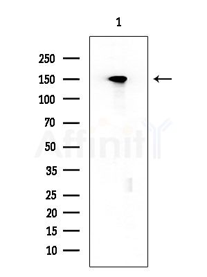 Phospho-EGFR (Ser1026) Antibody - Western blot analysis of extracts from EC304 cells, using Phospho-EGFR (Ser1026) Antibody at 1/1000 dilution.