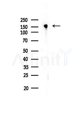 Phospho-EGFR (Ser1026) Antibody - Western blot analysis of lysates from EC304 cells, using Phospho-EGFR (Ser1026) Antibody at 1/1000 dilution.