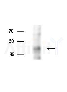 Phospho-c-Fos (Ser362) Antibody - Western blot analysis of extracts from B16F10-LUC cells(LPS,4h treatment), using Phospho-c-Fos (Ser362) Antibody at 1/1000 dilution.