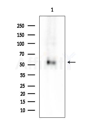 Phospho-c-Myc (Ser62) Antibody - Western blot analysis of extracts from COLO205 cells(heat-shock treatment), using Phospho-c-Myc (Ser62) Antibody at 1/1000 dilution.