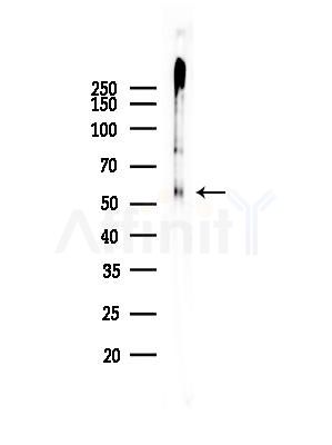 Phospho-c-Myc (Ser62) Antibody - Western blot analysis of lysates from COLO205 cells(heat-shock treatment), using Phospho-c-Myc (Ser62) Antibody at 1/1000 dilution.