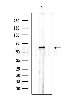 Phospho-c-Myc (Thr58) Antibody - Western blot analysis of extracts from Rat brain, using Phospho-c-Myc (Thr58) Antibody at 1/1000 dilution.