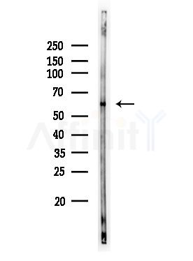 Phospho-c-Myc (Thr58) Antibody - Western blot analysis of lysates from Rat brain, using Phospho-c-Myc (Thr58) Antibody at 1/1000 dilution.
