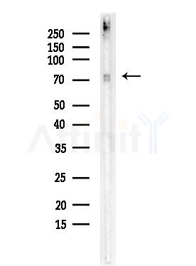 Phospho-Lamin A/C (Ser392) Antibody - Western blot analysis of lysates from COLO205 cells, using Phospho-Lamin A/C (Ser392) Antibody at 1/1000 dilution.