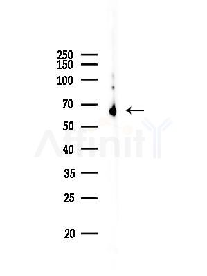 Phospho-Estrogen Receptor alpha (Ser104) Antibody - Western blot analysis of lysates from Mouse testis, using Phospho-Estrogen Receptor alpha (Ser104) Antibody at 1/1000 dilution.