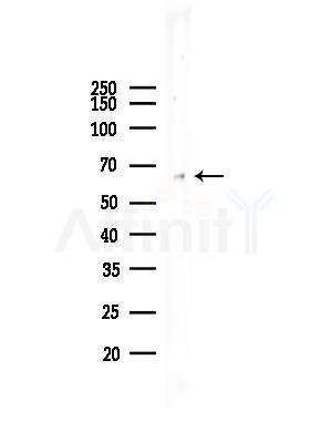 Phospho-Estrogen Receptor alpha (Ser104) Antibody - Western blot analysis of lysates from COLO205 cells(heat-shock treatment), using Phospho-Estrogen Receptor alpha (Ser104) Antibody at 1/1000 dilution.