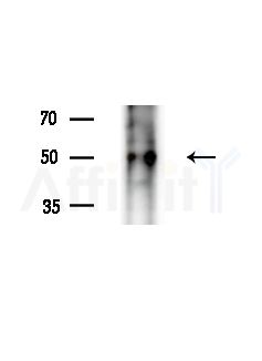 Phospho-Estrogen Receptor alpha (Ser106) Antibody - Western blot analysis of extracts from B16F10-LUC cells(LPS,4h treatment), using Phospho-Estrogen Receptor alpha (Ser106) Antibody at 1/1000 dilution.