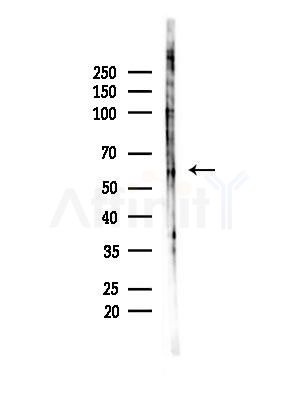 Phospho-Estrogen Receptor alpha (Ser106) Antibody - Western blot analysis of lysates from B16F10-LUC cells(LPS,4h treatment), using Phospho-Estrogen Receptor alpha (Ser106) Antibody at 1/1000 dilution.