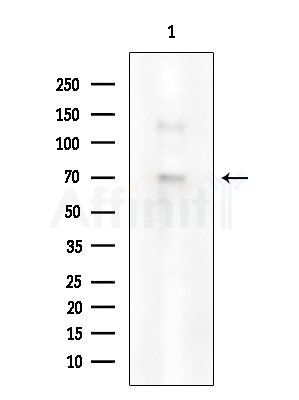 Phospho-Estrogen Receptor alpha (Ser118) Antibody - Western blot analysis of extracts from EC304 cells, using Phospho-Estrogen Receptor alpha (Ser118) Antibody at 1/1000 dilution.